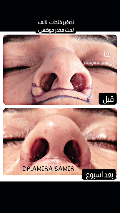 اميرة سمير
