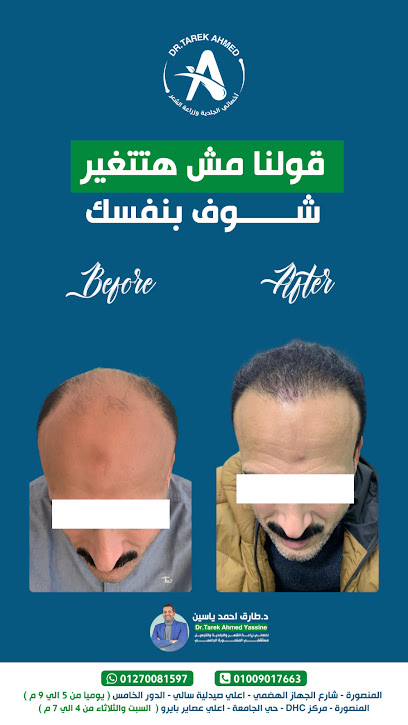 Tarek Yassine Hair transplantation