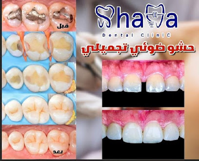 Abdallah Shamh🦷