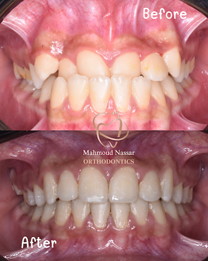 Mahmoud Nassar Orthodontics