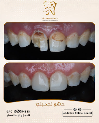 عبدالله ادريس كليله