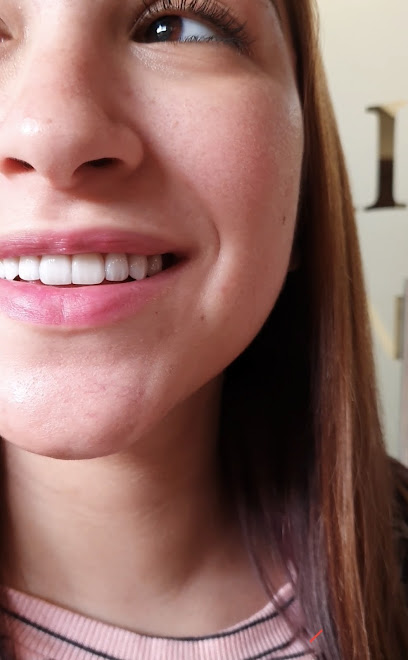 sherif harb Veneers