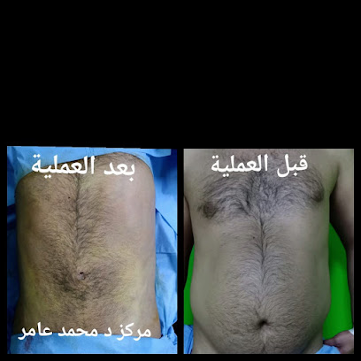 Mohamed Aamr