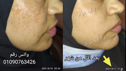آية فؤاد