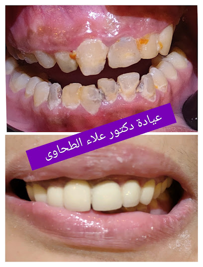 علاء الطحاوى