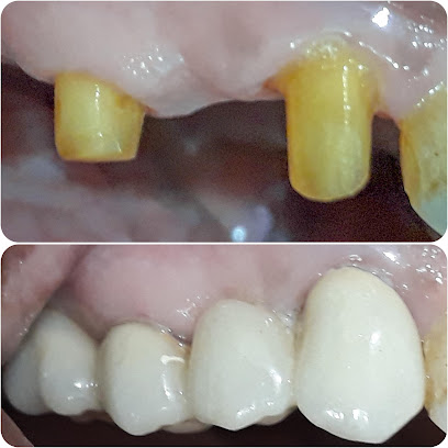 Shine Dent
