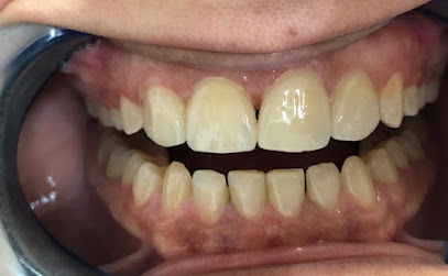 Fayed dentalaser