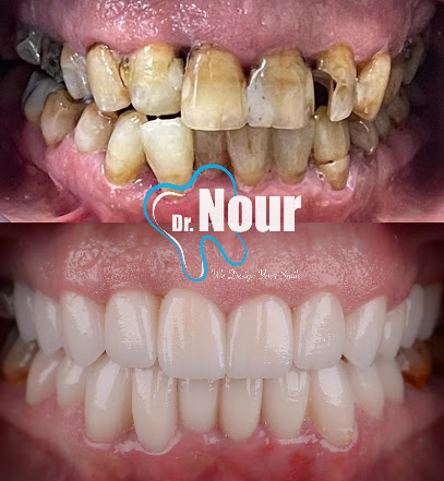 Nour Eldin Mostafa