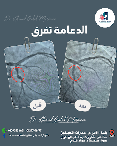 أحمد جلال مطاوع