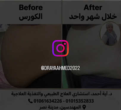 آيه أحمد عبد الرحمن