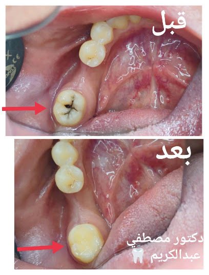 مصطفي عبدالكريم