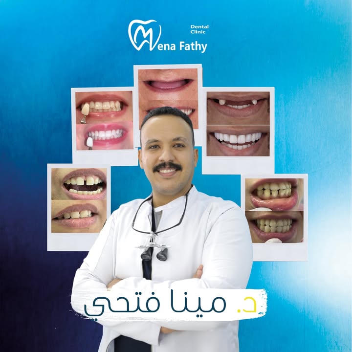 مينا فتحي